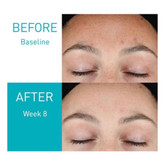 خرید سرم رتینول جوانساز و ضدجوش سراوی اصل ۳۰ میل