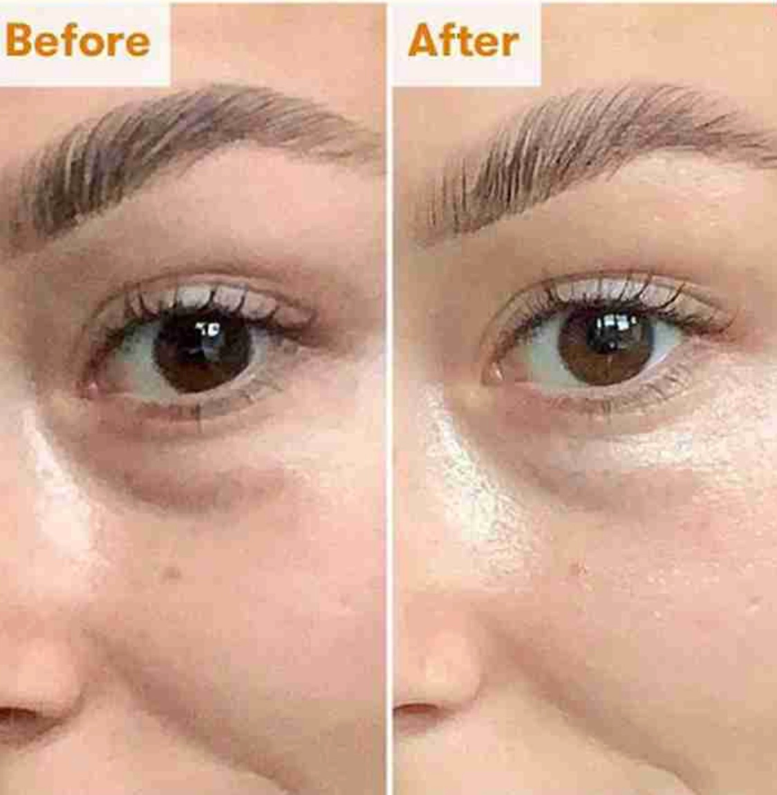 سفارش کرم دور چشم ضدچروک و روشن کننده کوزارکس
