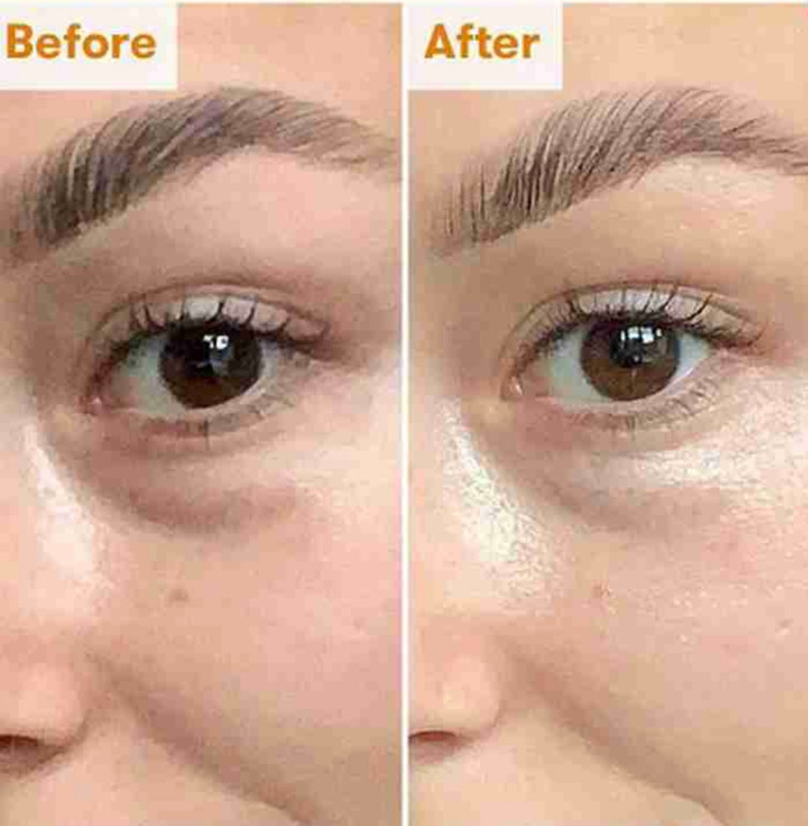 سفارش کرم دور چشم ضدچروک و روشن کننده کوزارکس