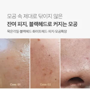 خریدماسک کنترل منافذ و جوش سرسیاه مدی کیوب