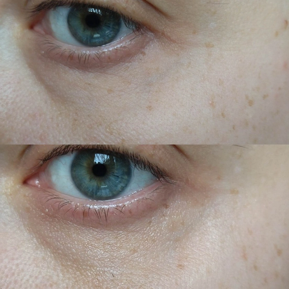 خرید کرم دورچشم ترمیم کننده کننده و ضدچروک مدی پیل حجم ۴۰ میل