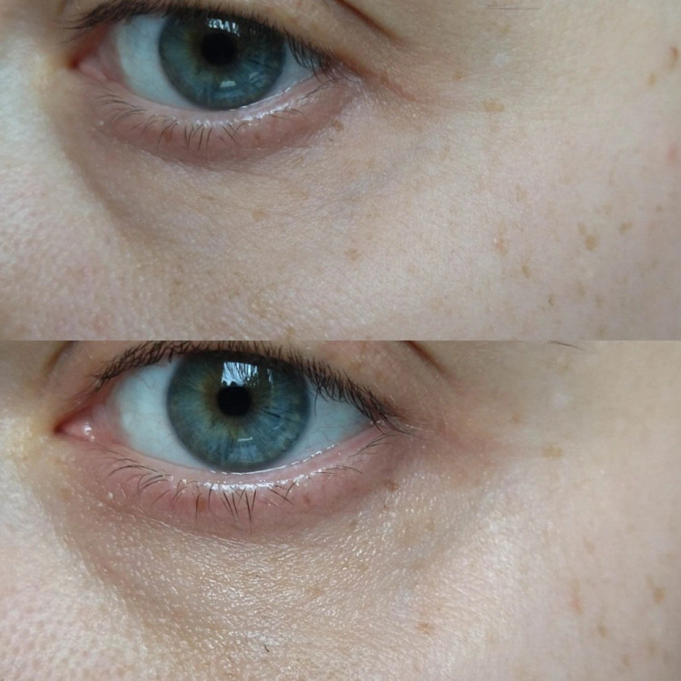 خرید کرم دورچشم ترمیم کننده کننده و ضدچروک مدی پیل حجم ۴۰ میل