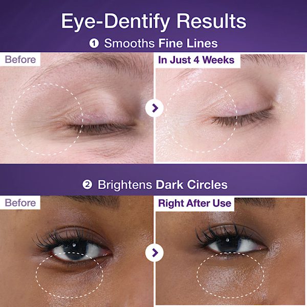 خرید کرم دور چشم ضد چروک و روشن کننده +NAD و رتینول شماره 9 نامبوزین حجم ۱۰ میل اورجینال