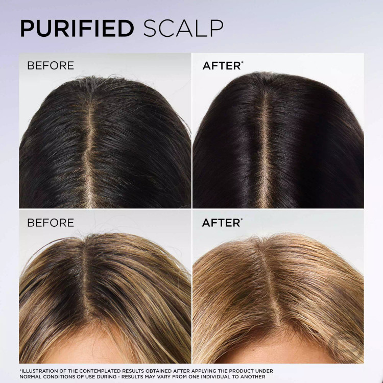 سفارش شامپو موی چرب لورال Elseve حاوی سالیسیلیک اسید با خاصیت ضد چربی حجم 300 میل اورجینال